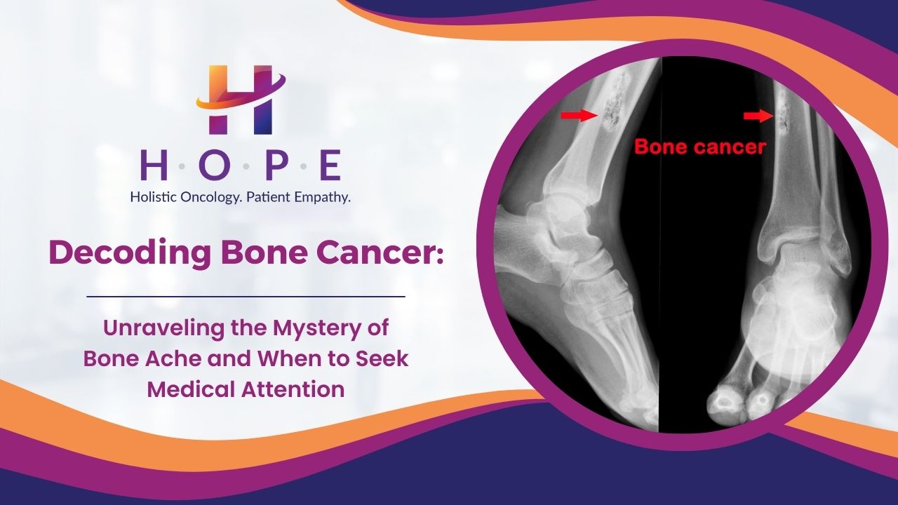 You are currently viewing Decoding Bone Cancer: Unraveling the Mystery of Bone Ache and When to Seek Medical Attention