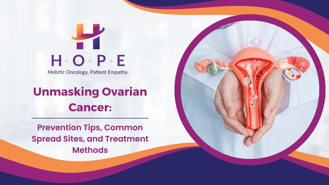 You are currently viewing Unmasking Ovarian Cancer: Prevention Tips, Common Spread Sites, and Treatment Methods